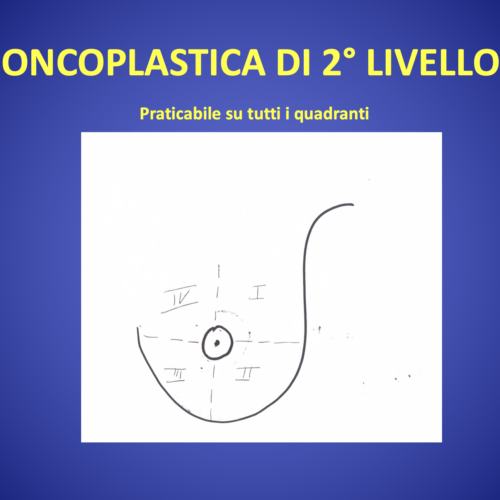 Interventi di chirurgia oncoplastica: quadrantectomia